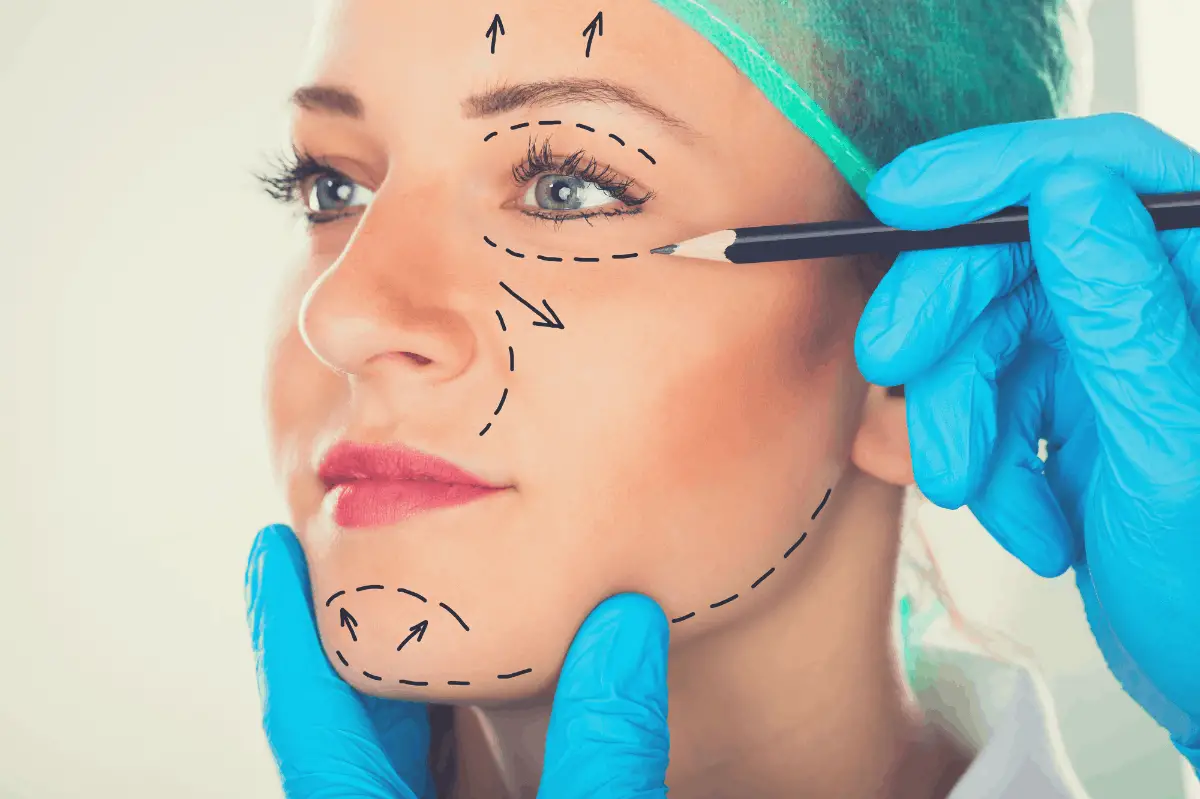 doctor drawing a facelift patient's face
