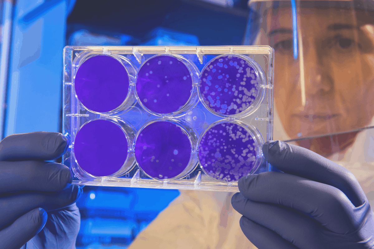 scientist checking bacteria results in the lab